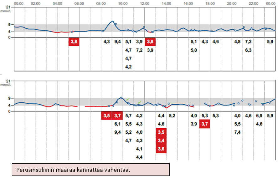 Esimerkkikuva sensorikäyrästä, jossa yleinen taso on turhan matala, verensokeri notkahtelee välillä matalan puolelle, ja lisäsyöntitarvetta on usein.